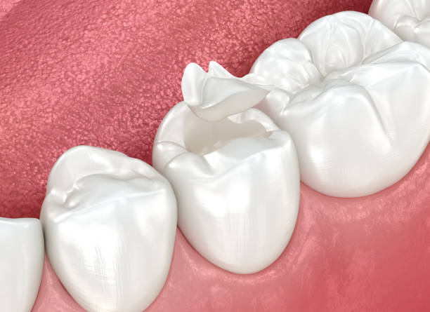 Our Range of Dental Services in Black Diamond, FL